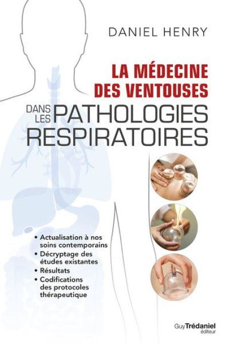 La médecine des ventouses dans les pathologies respiratoires